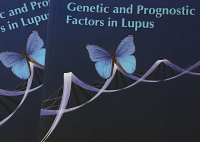 Thesis book: Genetic and Prognostic factors in Lupus